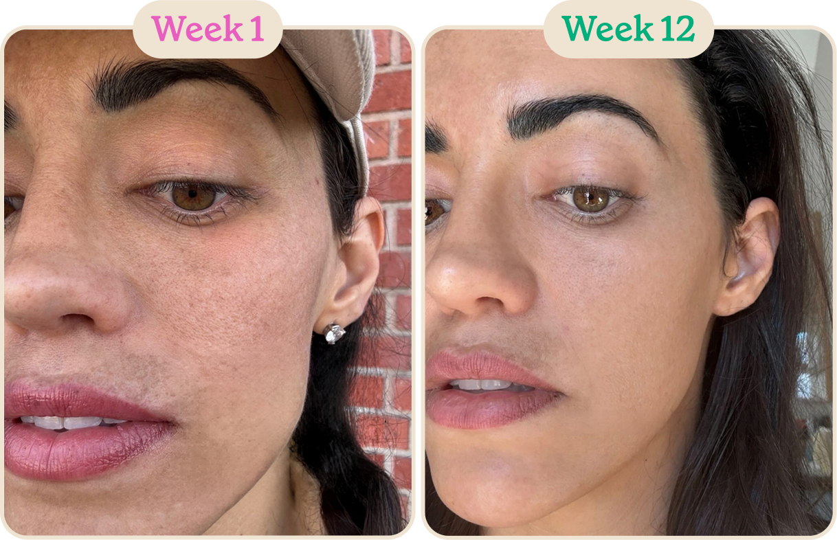 Marine elastin routine