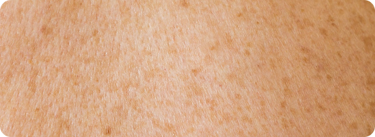 Close-up of smoother skin texture